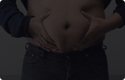 Belly fat gain